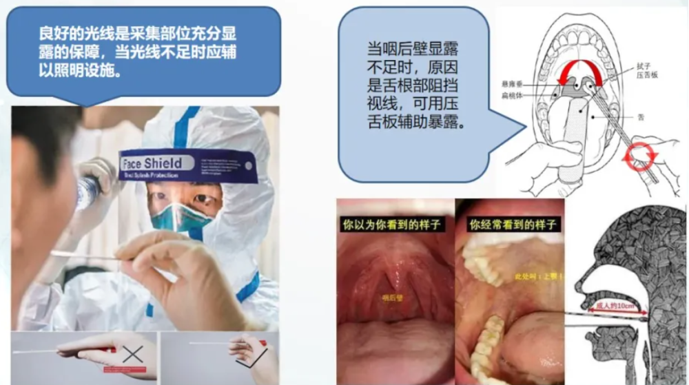 国家卫健委对核酸采样人员提出新要求_腾讯新闻