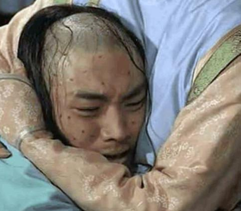 41年前天花终于被人类消灭这个让数亿人死亡的病魔如何消灭的