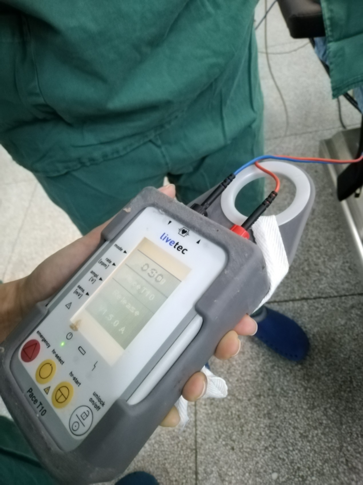 肥东县中医医院顺利完成首例心脏临时起搏器安装手术