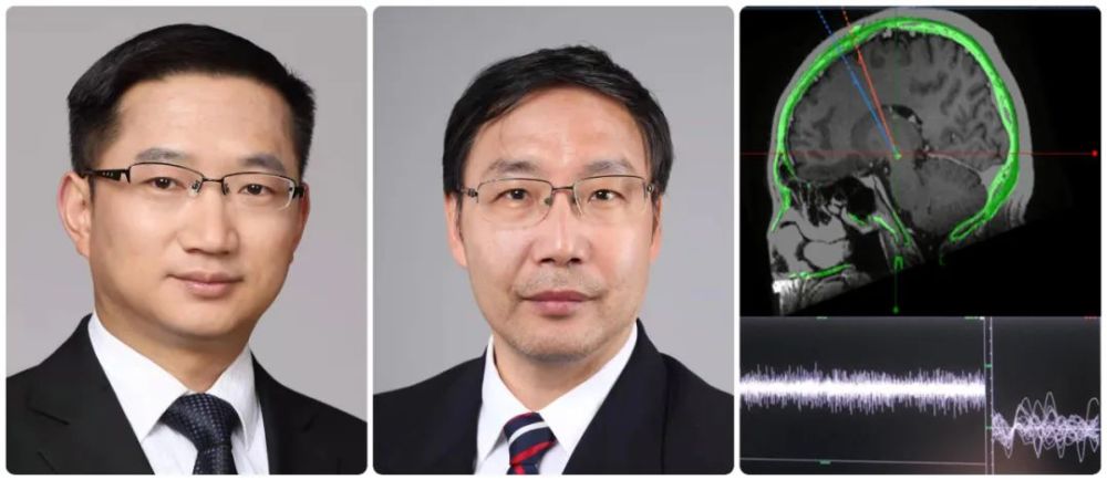 美敦力dbs特刊专访浙大二院罗巍朱君明基因检测和机器人辅助等技术