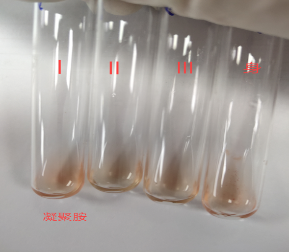 1例盐水间接抗人球蛋白试验鉴别交叉配血假凝集_腾讯新闻