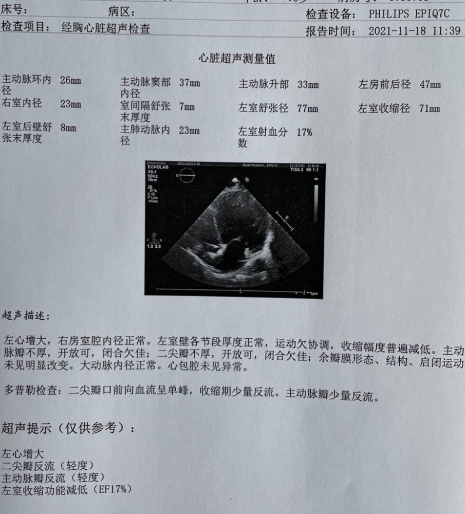 精彩病例丨cdqi名家面对面第六十四期一例宽qrs波心衰患者的起搏器