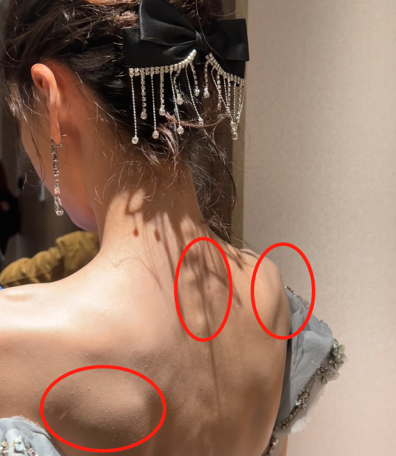 也有网友表示单单看baby瘦骨嶙峋的背部竟然像个老太太,还有种干瘪的