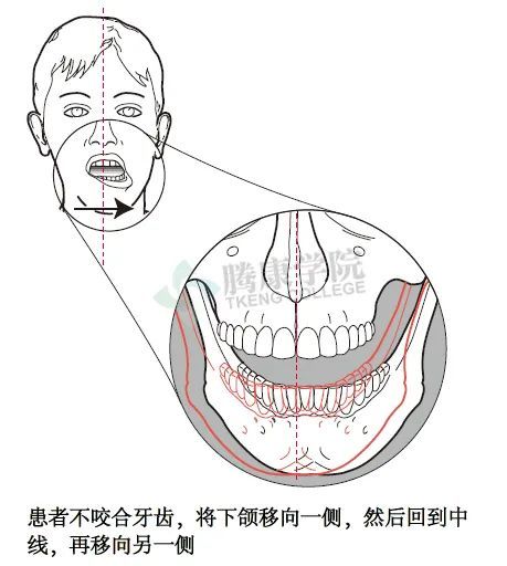 實用技巧顳下頜關節主動運動檢查