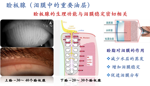 由上下眼睑内的睑板腺分泌,脂质层泪膜的结构:脂质层/水液层/黏液层