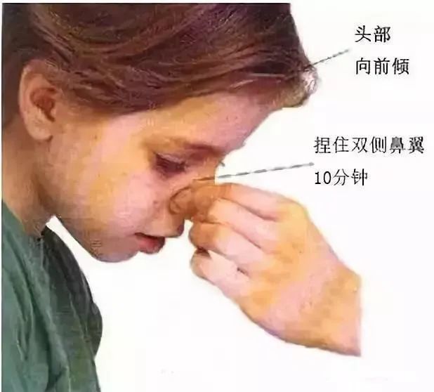 则代表着严重的出血,需要送医做进一步的止血处置,防止出血过多引起