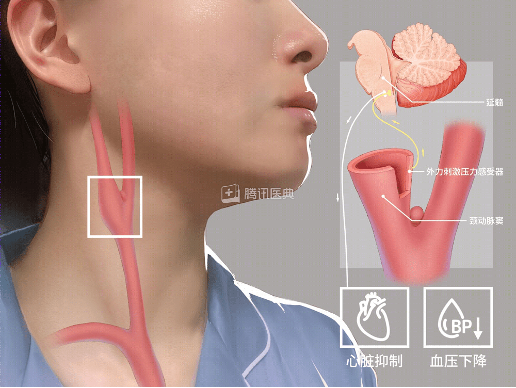 颈动脉窦位置真人图片图片