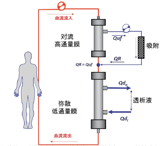 血液滤过吸附你需要了解的新技术之一