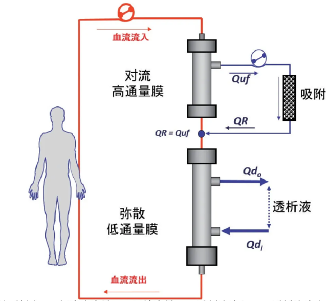 血液透析滤过原理图图片