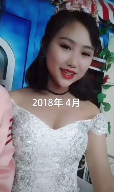 19岁"凉山孟阳"被曝整容,结婚照曝光,网友吐槽像换了个头