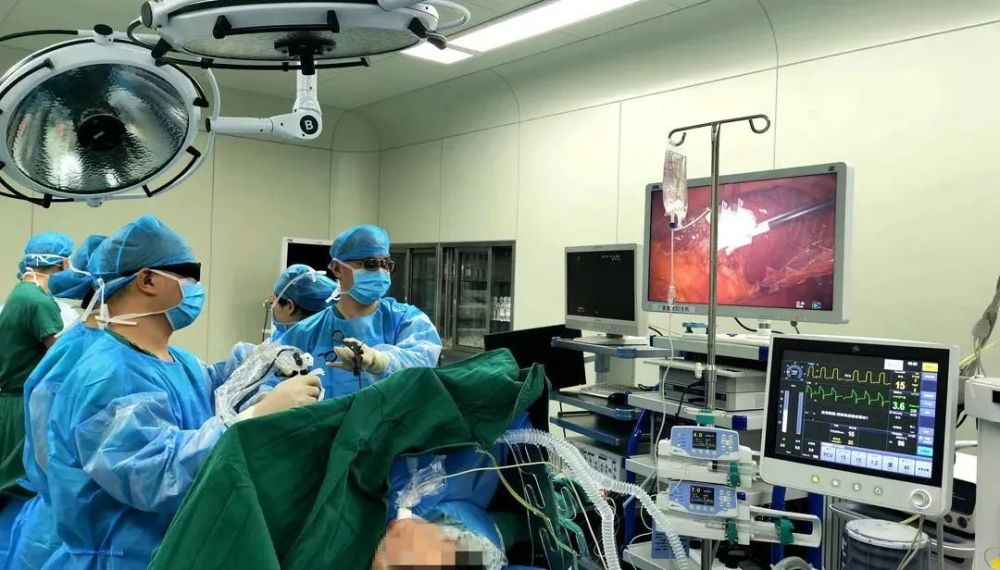 带上3d眼镜做手术省二医运用腹腔镜立体成像技术完成一例胃大部切除术