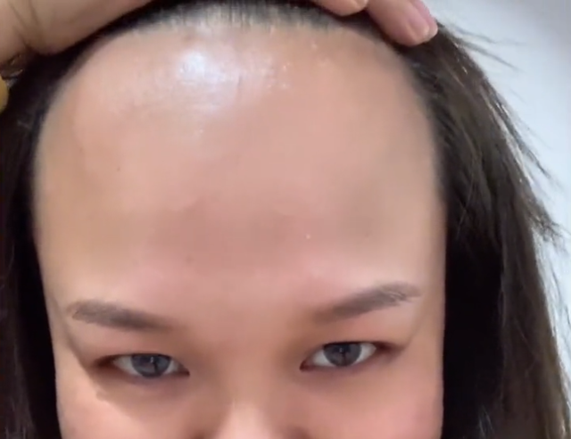 陕西女子隔离期发现1岁女儿前后发际线超高晒出自己后网友笑喷