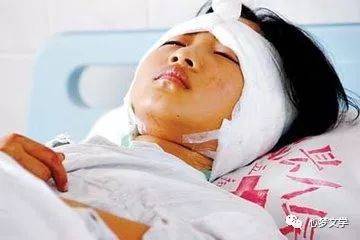 来自网络不小心被一辆呼啸而过的汽车撞晕,醒来后,才发现自己头部受伤