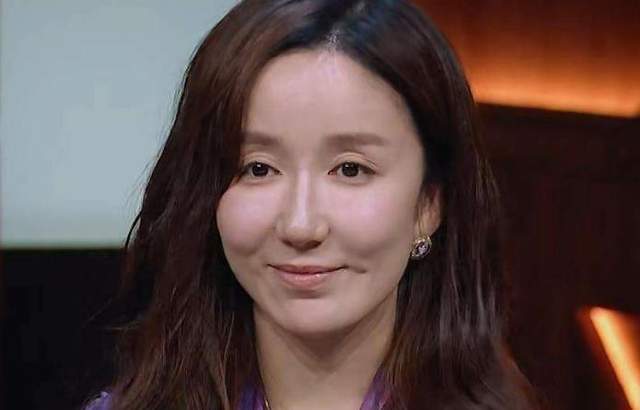 真的不要医美过度张雨绮近照脸僵不能大笑网友恢复期别乱跑