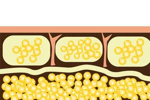 医美科普|普通脂肪,纳米脂肪,脂肪胶有啥区别?