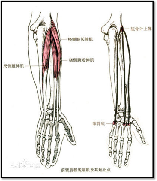 高爾夫肘需要注意的肌肉:橈側腕屈肌,短伸肌_騰訊新聞