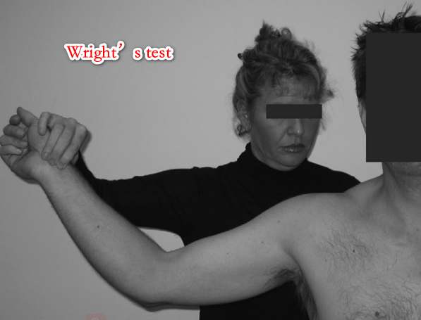 图6 wright testadson test:伸展手臂,将头转向患侧,深呼吸;如果桡