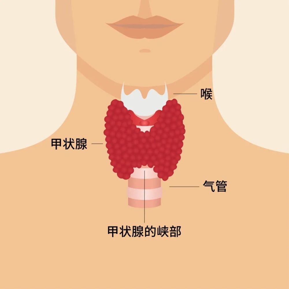 甲状腺软骨疼图片