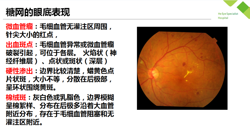 瀋陽何氏眼科醫院王歡眼底照相那些事上