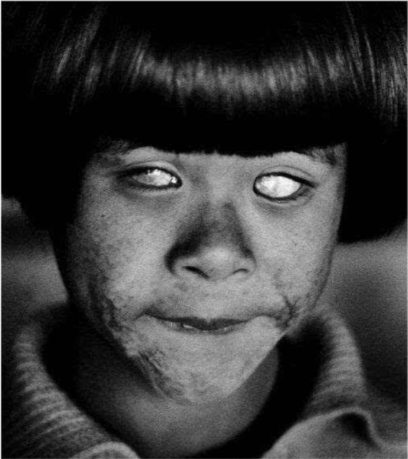 人瞬间失明,幸存者:街上都是缓慢行走的鬼