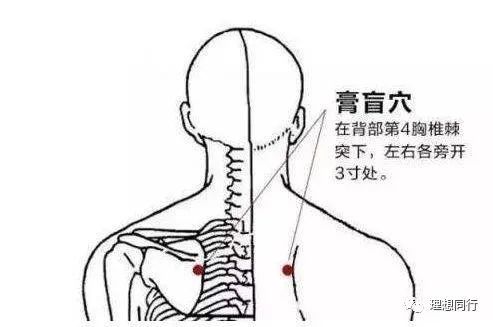 膏肓穴是起死回生的妙穴重病不知如何治时灸膏肓