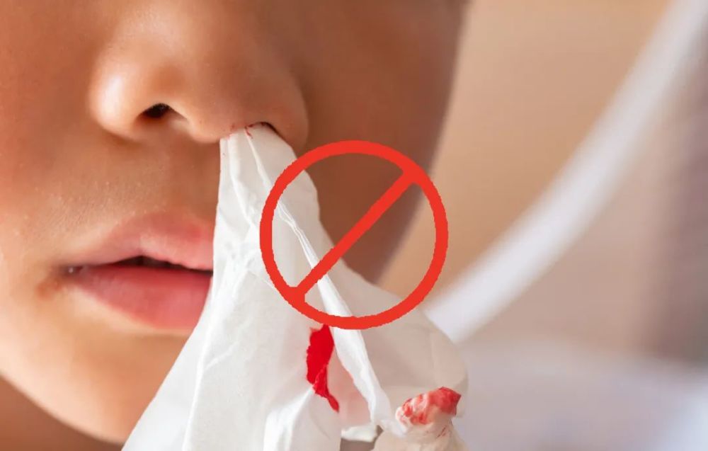 这样能降低鼻子静脉中的血压,阻止进一步出血,也能避免鼻血流向口咽部