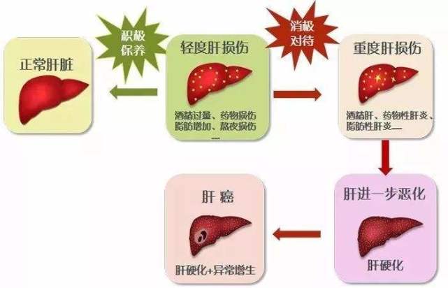 乙肝和正常人的肝图片图片