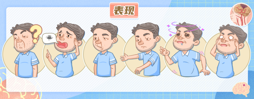 平衡障碍,突然出现眩晕,走路不稳;肢体的轻度无力,双臂同时平举于胸前