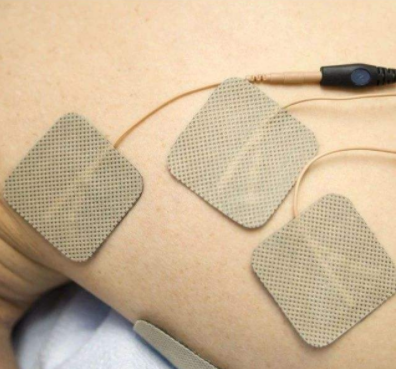 治疗动力性腰肌劳损电针灸低中频脉冲电疗法效果更好你用过吗