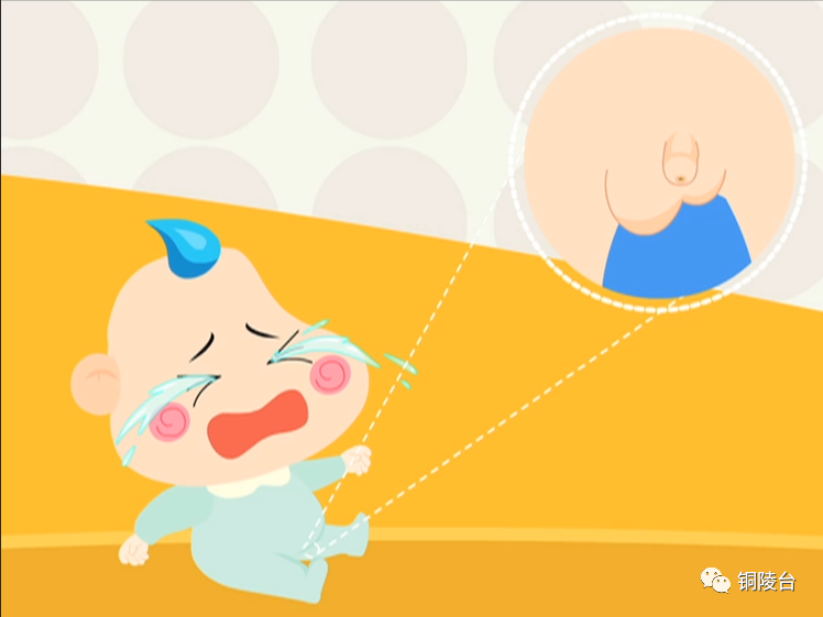 市立医院专家为您科普小儿疝气不是气家长莫大意