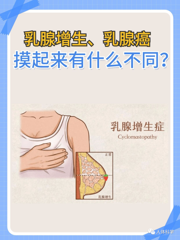 女性健康乳腺增生乳腺癌摸起來有什麼不同