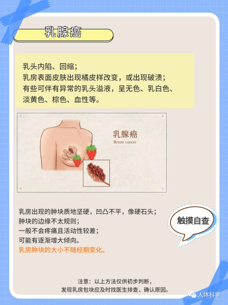 女性健康乳腺增生乳腺癌摸起来有什么不同