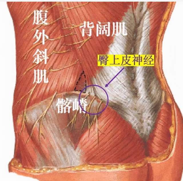 怎么也治不好的坐骨神经痛原来是臀上皮神经炎怎样区别这两种病