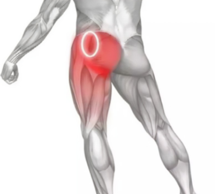 怎么也治不好的坐骨神经痛原来是臀上皮神经炎怎样区别这两种病