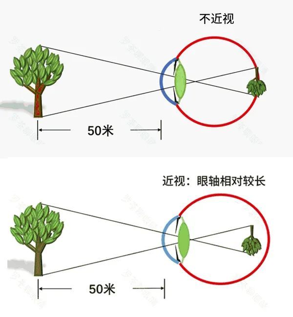 近视的人迟早要戴两副眼镜1的幸运儿除外