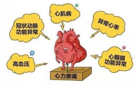 心衰是心力衰竭简称,指的是严重的心功能不全,即心脏的收缩功能和(或)