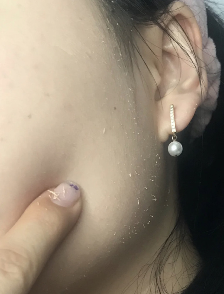 为什么你用大牌护肤品,还是搓泥?除了角质层太厚,还有这几点_腾讯新闻