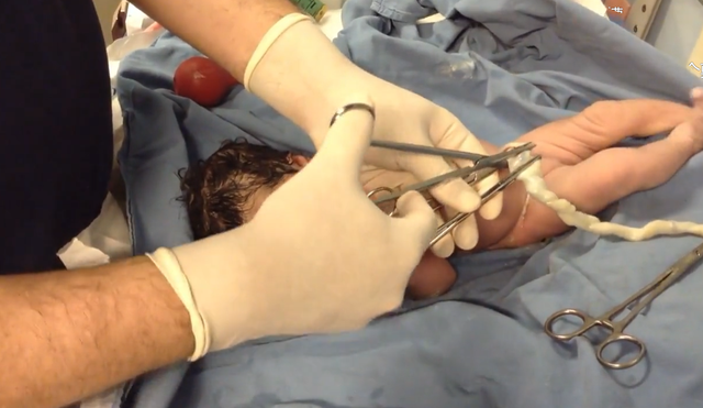 我也真的是第一次仔细看新生儿宝宝剪断脐带的过程,虽然只有不到2分钟