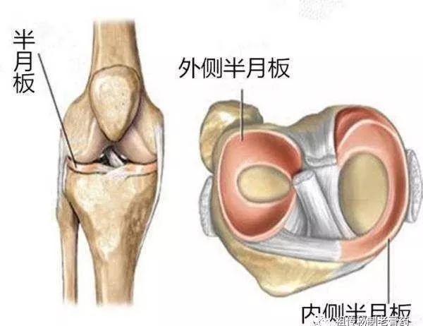膝盖半月板损伤，多久可以恢复？