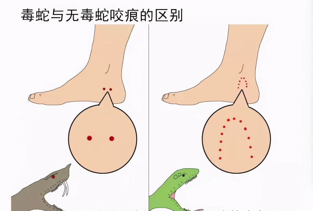 湖北男子被蛇"追踪"5年,死后坟头成"蛇窝",专家道出了真相_腾讯新闻