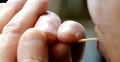 看了这个,你还敢用牙签剔牙吗?当心牙缝变宽