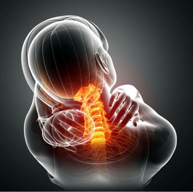 需注意体检查出颈椎反弓说明颈椎变形已经很严重了