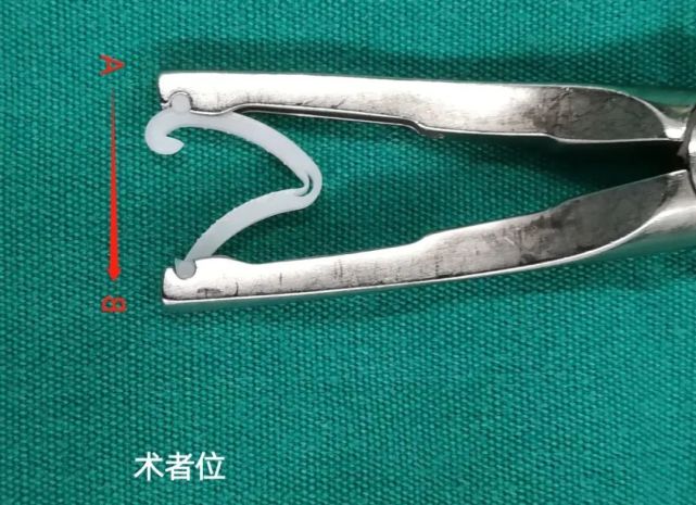 每天都用hemolok夹这个细节90医生都没注意到