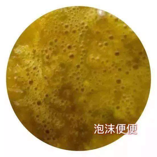 寶寶拉綠色大便是怎麼回事寶寶便便的形狀以及解決辦法