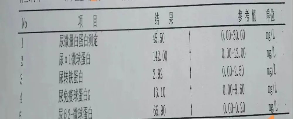 圖2 尿微量蛋白五項蛋白尿的定因對於真性蛋白尿,明確了定量,定位以外