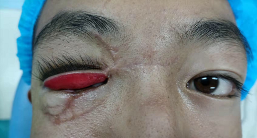 彩钢房不幸坠落，尕马经历了人生最难的3个月(图1)