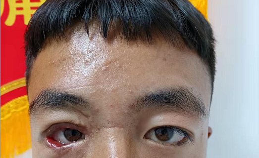 彩钢房不幸坠落，尕马经历了人生最难的3个月(图2)