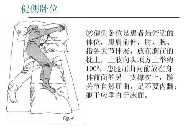 鼓励患侧卧位,适当健侧卧位,尽可能少采取仰卧位,尽量避免半卧位,保持