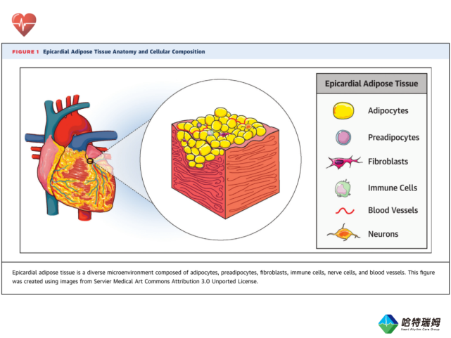 【心·声】心外膜脂肪组织与心律失常