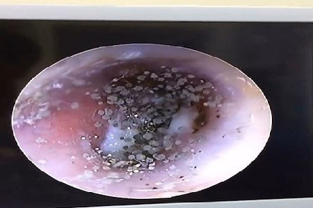 生活中总是耳朵痒该怎么办